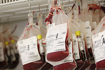 Dangerous blood transfusions: What can help reduce the risk? 